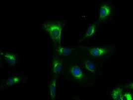 SOX17 Antibody in Immunocytochemistry (ICC/IF)