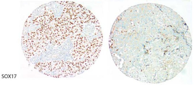 SOX17 Antibody in Immunohistochemistry (Paraffin) (IHC (P))