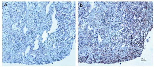 NTF3 Antibody in Immunohistochemistry (Paraffin) (IHC (P))