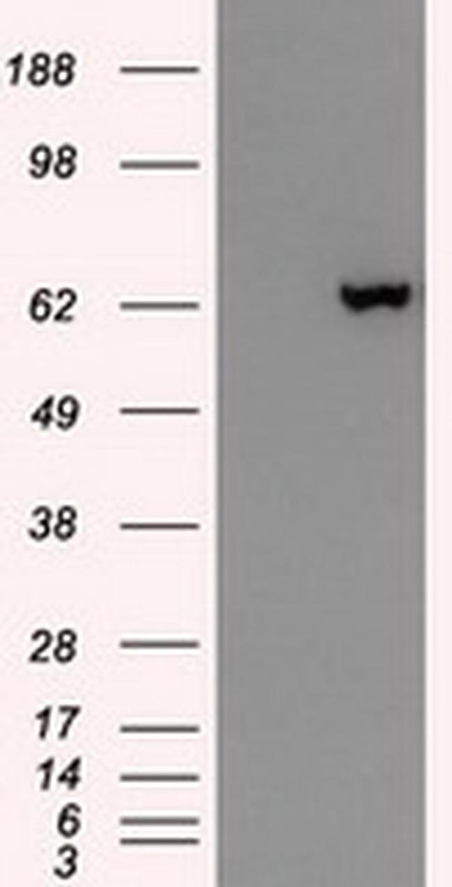 GAD67 Antibody in Western Blot (WB)