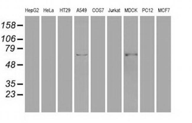 GAD67 Antibody in Western Blot (WB)