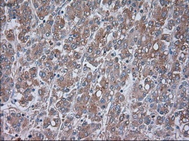 TRPM4 Antibody in Immunohistochemistry (Paraffin) (IHC (P))