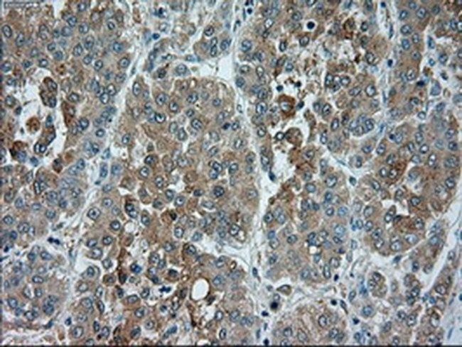 TRPM4 Antibody in Immunohistochemistry (Paraffin) (IHC (P))