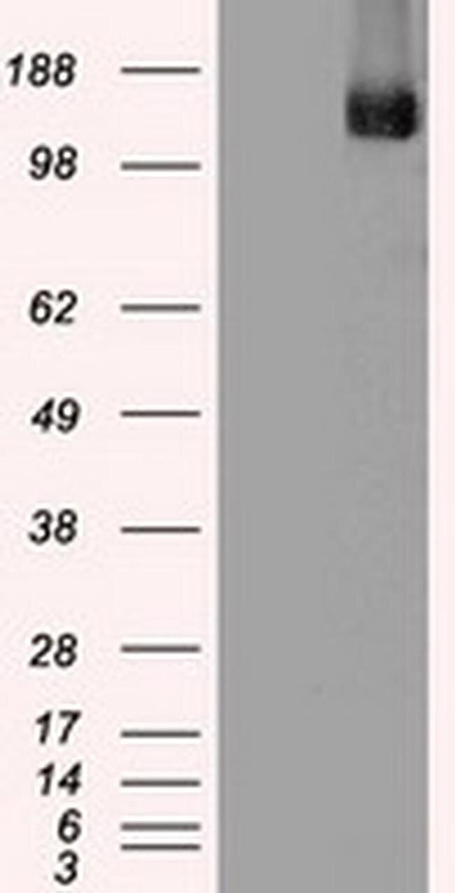 TRPM4 Antibody in Western Blot (WB)