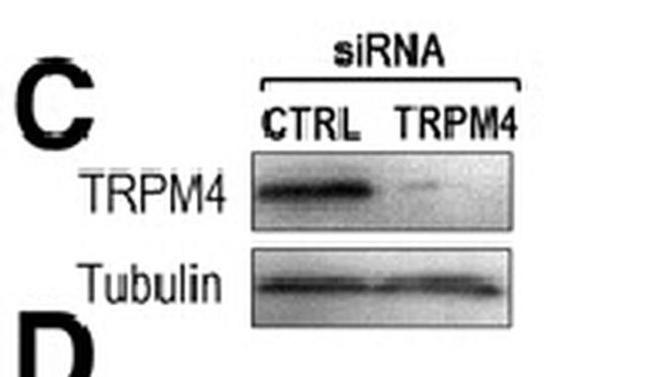 TRPM4 Antibody in Western Blot (WB)