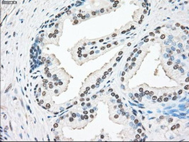 SSB Antibody in Immunohistochemistry (Paraffin) (IHC (P))