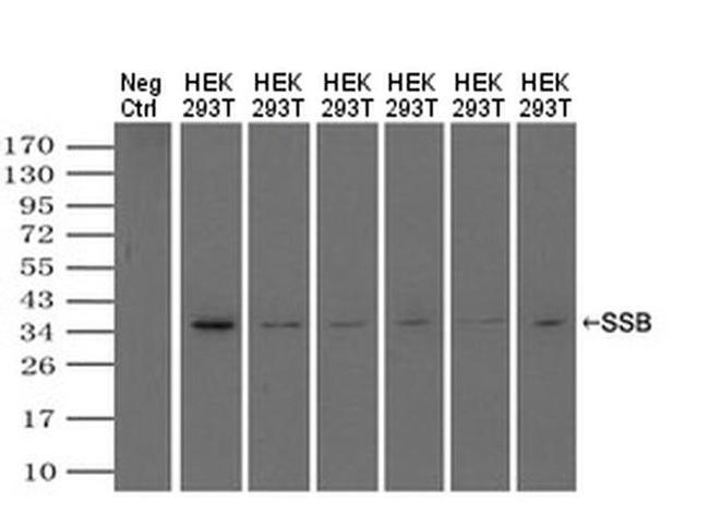 SSB Antibody in Western Blot (WB)