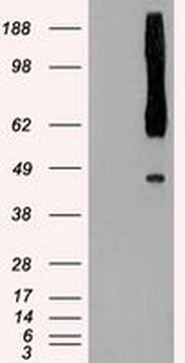 RAD9 Antibody in Western Blot (WB)