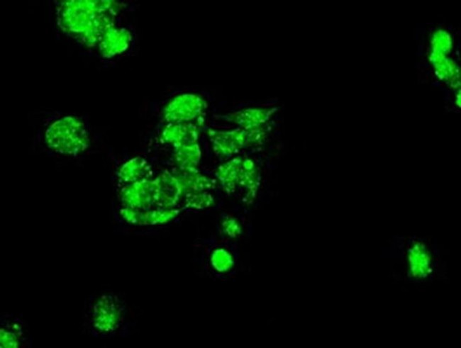 Kindlin 2 Antibody in Immunocytochemistry (ICC/IF)