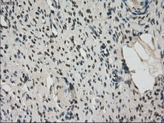 Kindlin 2 Antibody in Immunohistochemistry (Paraffin) (IHC (P))