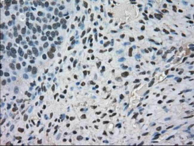 Kindlin 2 Antibody in Immunohistochemistry (Paraffin) (IHC (P))