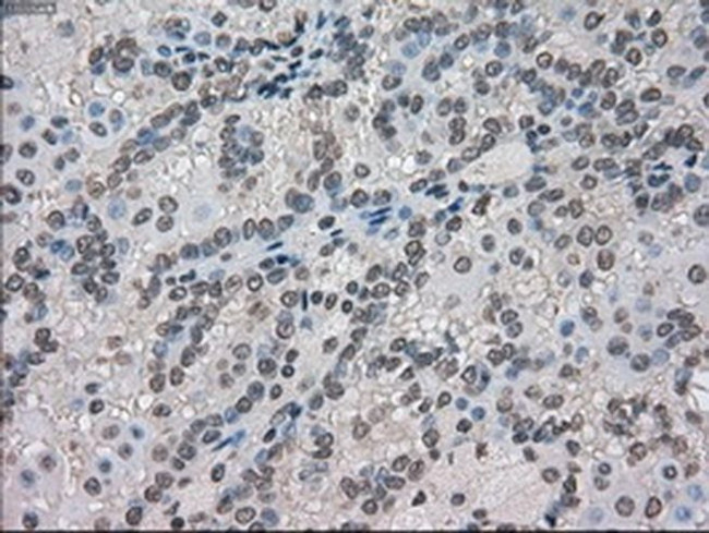 Kindlin 2 Antibody in Immunohistochemistry (Paraffin) (IHC (P))