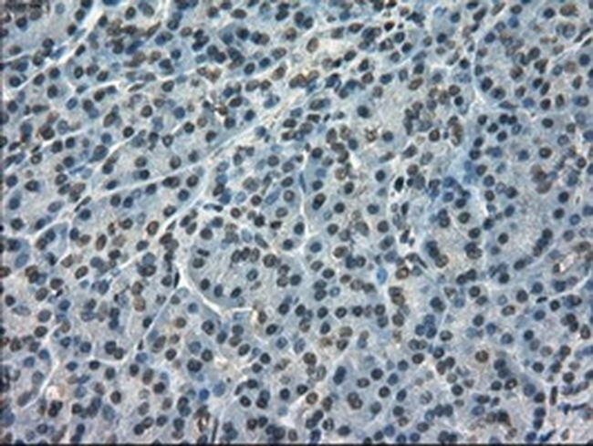 Kindlin 2 Antibody in Immunohistochemistry (Paraffin) (IHC (P))