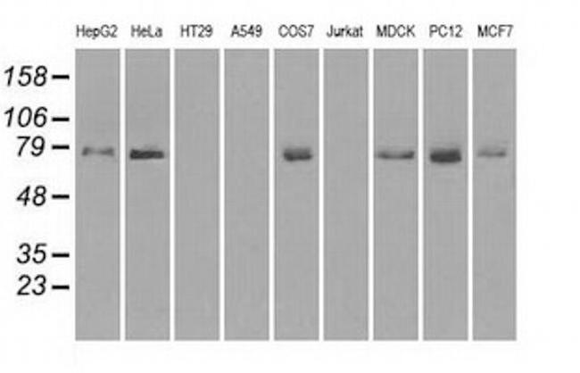 Kindlin 2 Antibody in Western Blot (WB)