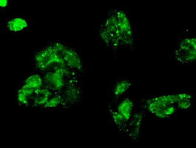 Kindlin 2 Antibody in Immunocytochemistry (ICC/IF)