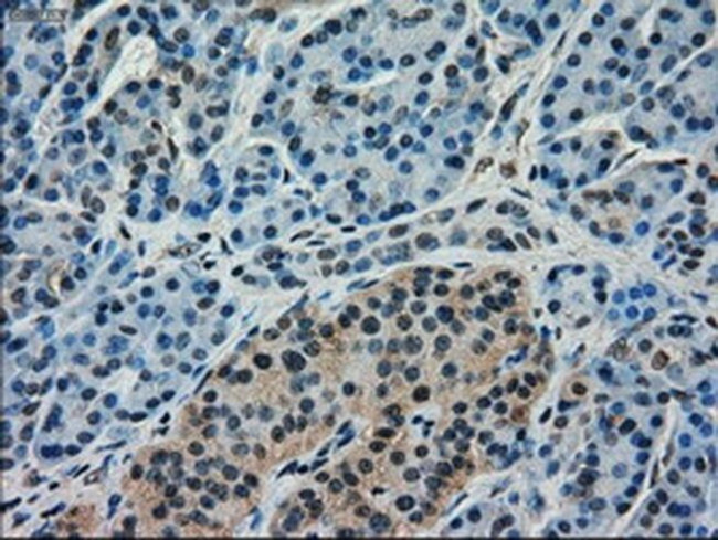 Kindlin 2 Antibody in Immunohistochemistry (Paraffin) (IHC (P))