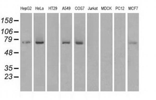 Kindlin 2 Antibody in Western Blot (WB)