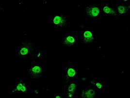 TRIB2 Antibody in Immunocytochemistry (ICC/IF)