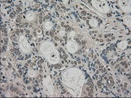 TRIB2 Antibody in Immunohistochemistry (Paraffin) (IHC (P))