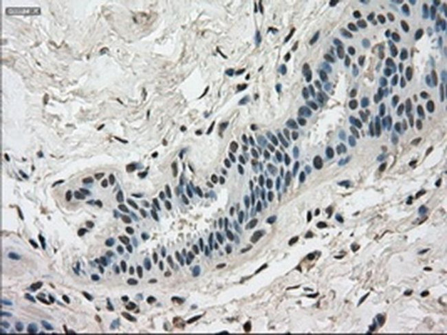 DHFR Antibody in Immunohistochemistry (Paraffin) (IHC (P))