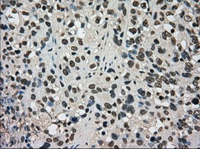 DHFR Antibody in Immunohistochemistry (Paraffin) (IHC (P))