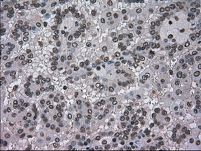 DHFR Antibody in Immunohistochemistry (Paraffin) (IHC (P))