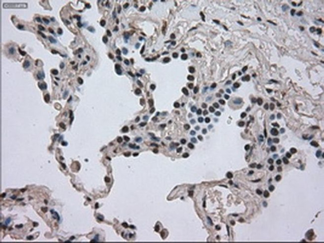 DHFR Antibody in Immunohistochemistry (Paraffin) (IHC (P))