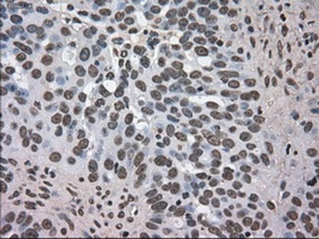 DHFR Antibody in Immunohistochemistry (Paraffin) (IHC (P))