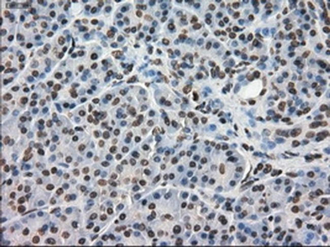 DHFR Antibody in Immunohistochemistry (Paraffin) (IHC (P))