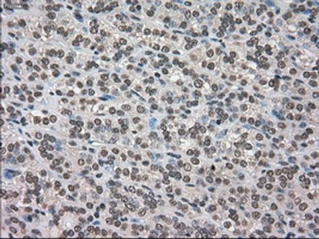 DHFR Antibody in Immunohistochemistry (Paraffin) (IHC (P))