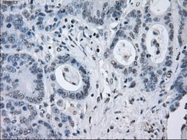 SATB1 Antibody in Immunohistochemistry (Paraffin) (IHC (P))