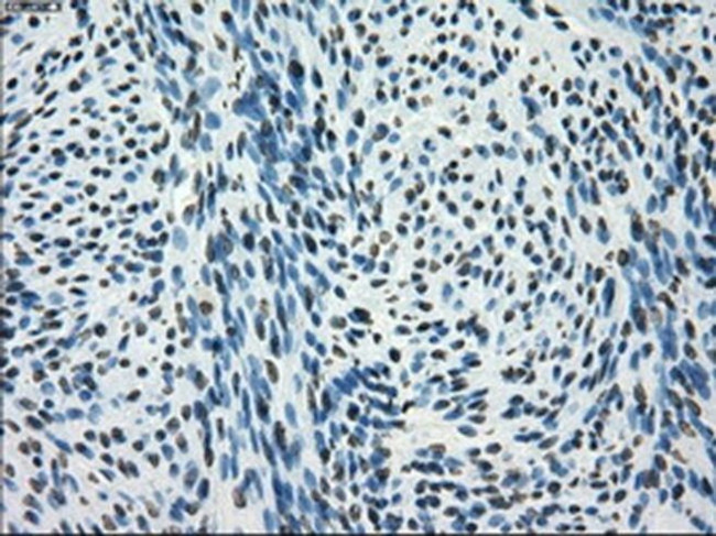 SATB1 Antibody in Immunohistochemistry (Paraffin) (IHC (P))