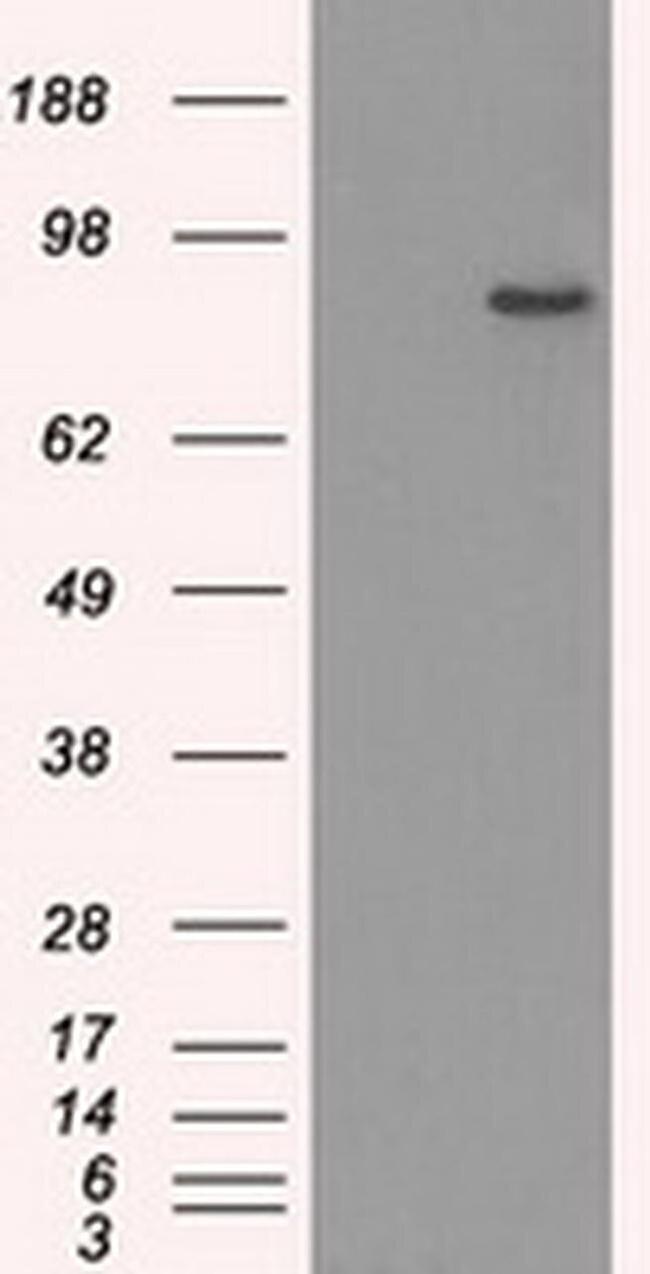 SATB1 Antibody in Western Blot (WB)