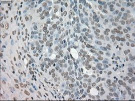 NEK6 Antibody in Immunohistochemistry (Paraffin) (IHC (P))