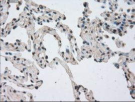 NEK6 Antibody in Immunohistochemistry (Paraffin) (IHC (P))