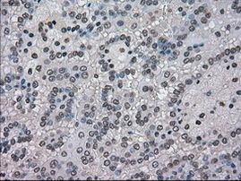 NEK6 Antibody in Immunohistochemistry (Paraffin) (IHC (P))