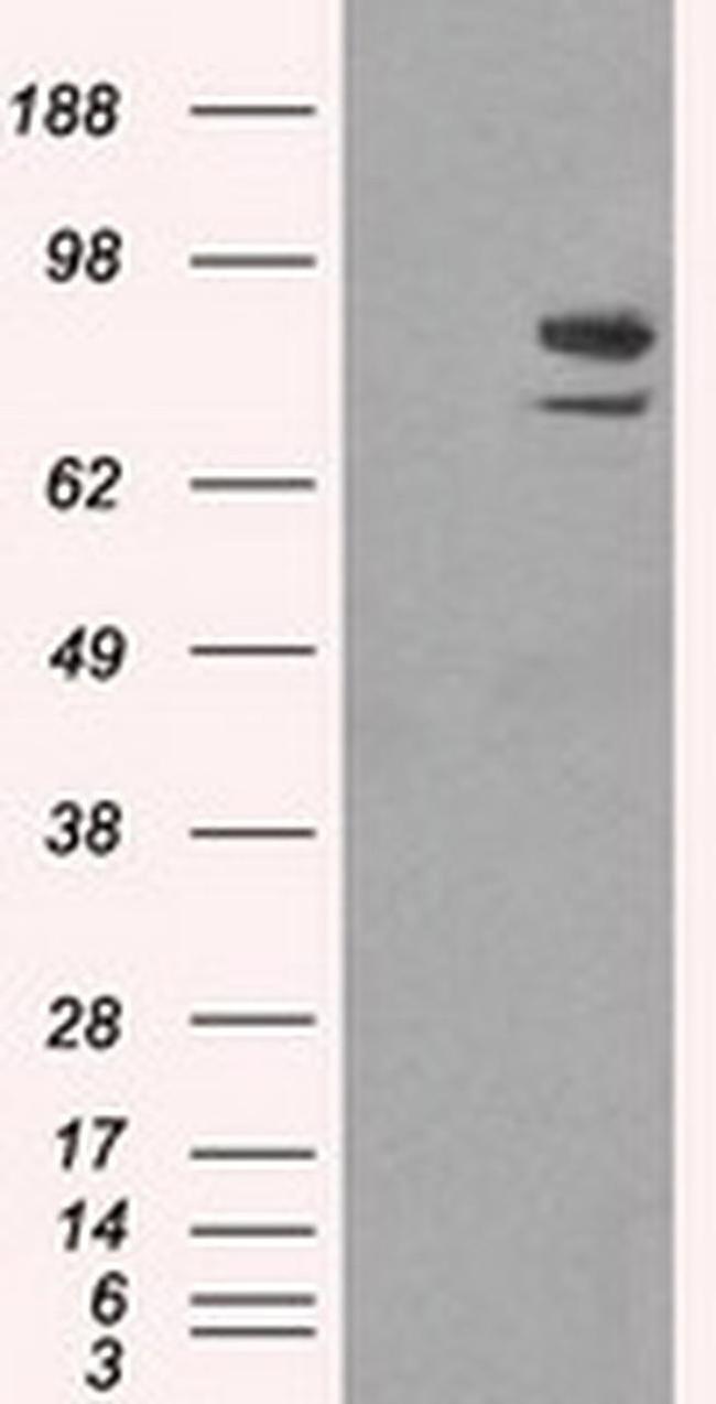 SATB1 Antibody in Western Blot (WB)