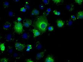 PP5 Antibody in Immunocytochemistry (ICC/IF)