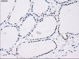 PP5 Antibody in Immunohistochemistry (Paraffin) (IHC (P))