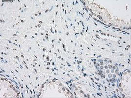 PP5 Antibody in Immunohistochemistry (Paraffin) (IHC (P))