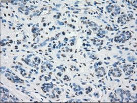 PP5 Antibody in Immunohistochemistry (Paraffin) (IHC (P))