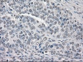 PP5 Antibody in Immunohistochemistry (Paraffin) (IHC (P))