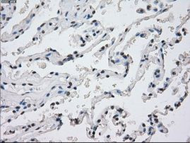 PP5 Antibody in Immunohistochemistry (Paraffin) (IHC (P))