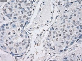 PP5 Antibody in Immunohistochemistry (Paraffin) (IHC (P))