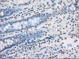 PP5 Antibody in Immunohistochemistry (Paraffin) (IHC (P))