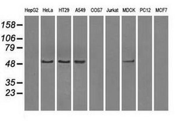 PP5 Antibody in Western Blot (WB)