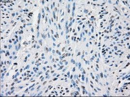 PP5 Antibody in Immunohistochemistry (Paraffin) (IHC (P))