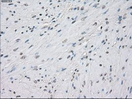 PP5 Antibody in Immunohistochemistry (Paraffin) (IHC (P))