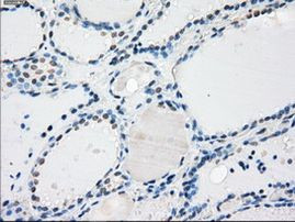 PP5 Antibody in Immunohistochemistry (Paraffin) (IHC (P))