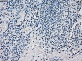 PP5 Antibody in Immunohistochemistry (Paraffin) (IHC (P))